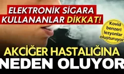 Elektronik sigara kullananlar dikkat! Akciğerlerde kovid benzeri lezyonlar oluşturuyor