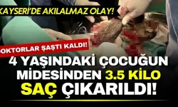 Doktorlar şaştı kaldı! 14 yaşındaki çocuğun midesinden 3.5 kilo saç çıkarıldı!